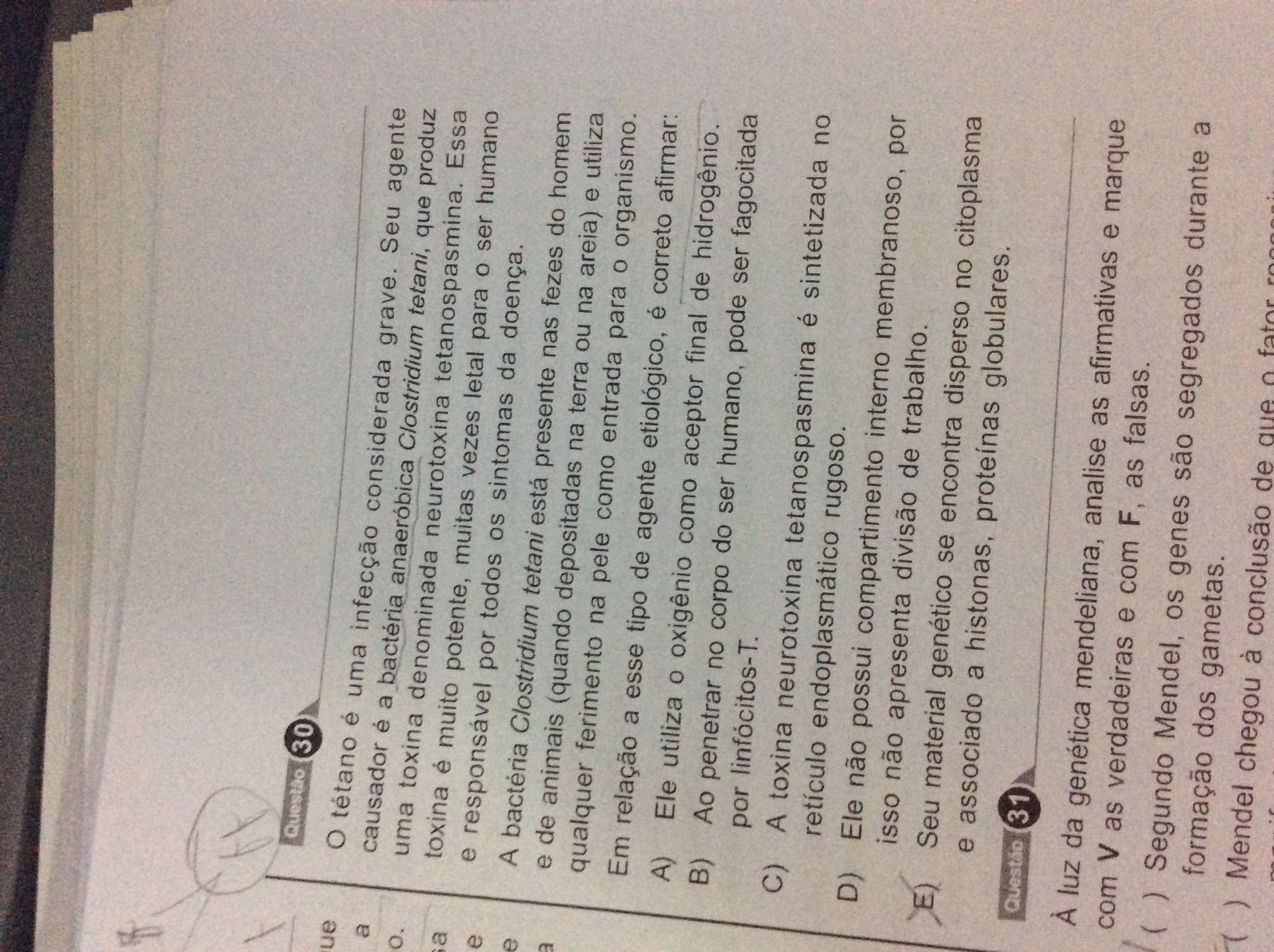 30 gabarito letra D pq nao pode ser letraE Explicaê